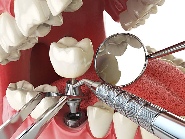 Best Emergency Treatment for Toothache in , IA